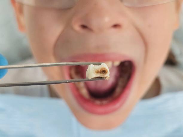Best Emergency Denture Repair in Dilworth, MN