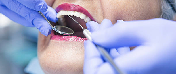 Best Broken or Chipped Tooth Repair in Dilworth, MN